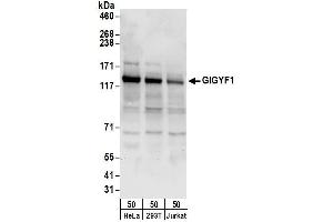 anti-GRB10 Interacting GYF Protein 1 (GIGYF1) (AA 350-400) antibody