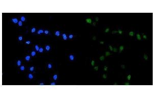 IF analysis of TOP2A using anti-TOP2A antibody (ABIN7602988).