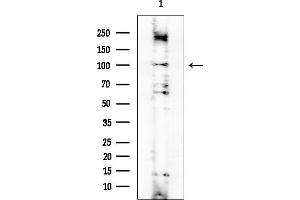 anti-Adenylate Cyclase 2 (Brain) (ADCY2) (Internal Region) antibody
