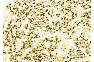 ABIN6277282 at 1/100 staining Human lung tissue by IHC-P. (PDCD4 antibody  (N-Term))