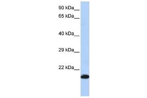 GPX4 antibody used at 1 ug/ml to detect target protein.