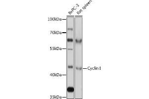 Western blot analysis of extracts of various cell lines, using Cyclin I antibody (ABIN7266570) at 1:1000 dilution. (Cyclin I antibody  (AA 257-377))