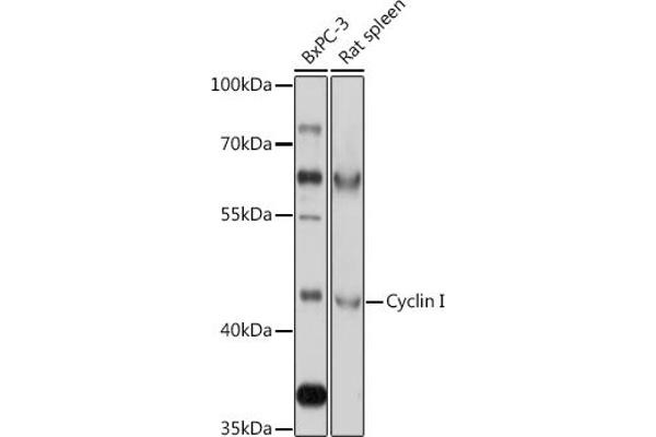 Cyclin I 抗体  (AA 257-377)