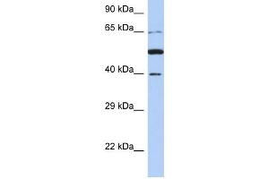 PNMA3 antibody used at 1 ug/ml to detect target protein. (PNMA3 antibody  (N-Term))