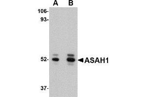 Western Blotting (WB) image for anti-N-Acylsphingosine Amidohydrolase (Acid Ceramidase) 1 (ASAH1) (C-Term) antibody (ABIN1030257) (ASAH1 antibody  (C-Term))