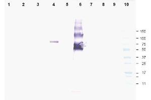 Image no. 1 for anti-Ankyrin Repeat Domain 26 (ANKRD26) (AA 1-15), (N-Term) antibody (ABIN401330)