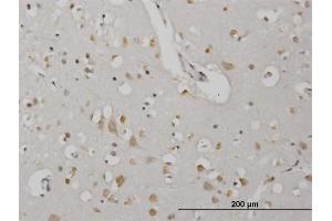 Immunoperoxidase of monoclonal antibody to CDKL2 on formalin-fixed paraffin-embedded human cerebral cortex. (CDKL2 antibody  (AA 394-493))