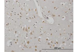 Immunoperoxidase of monoclonal antibody to CDKL2 on formalin-fixed paraffin-embedded human cerebral cortex.