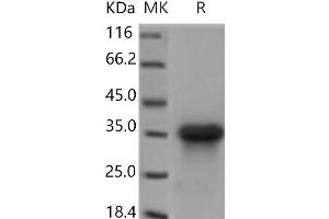 Western Blotting (WB) image for Lymphotoxin beta Receptor (TNFR Superfamily, Member 3) (LTBR) protein (His tag) (ABIN7321202) (LTBR Protein (His tag))