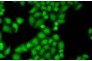 Immunofluorescence analysis of MCF7 cells using GTF2F1 Polyclonal Antibody (GTF2F1 antibody)