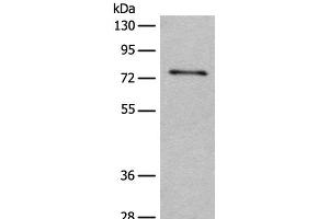 Western blot analysis of Human hepatocellular carcinoma 2 tissue lysate using ADGRE3 Polyclonal Antibody at dilution of 1:400 (EMR3 antibody)