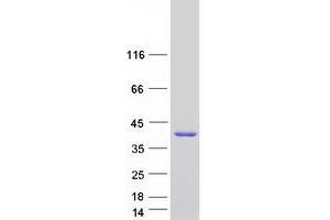 Validation with Western Blot (SULT1A4 Protein (Transcript Variant 2) (Myc-DYKDDDDK Tag))