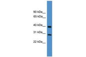 Image no. 1 for anti-Metalloproteinase Inhibitor 2 (TIMP2) (AA 130-179) antibody (ABIN6745438) (TIMP2 antibody  (AA 130-179))
