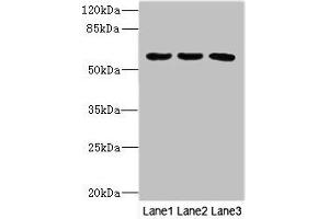 PIK3R3 antibody  (Regulatory Subunit Gamma)