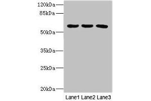 Western blot All lanes: PIK3R3 antibody at 3. (PIK3R3 antibody  (Regulatory Subunit Gamma))