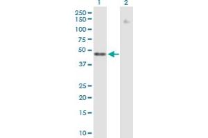 Western Blot analysis of ZNF776 expression in transfected 293T cell line by ZNF776 MaxPab polyclonal antibody. (ZNF776 antibody  (AA 1-476))