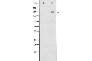 Western blot analysis of Met expression in HepG2 whole cell lysates,The lane on the left is treated with the antigen-specific peptide. (c-MET antibody  (C-Term))