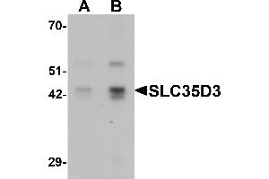 Western Blotting (WB) image for anti-Solute Carrier Family 35, Member D3 (SLC35D3) (C-Term) antibody (ABIN1077364) (SLC35D3 antibody  (C-Term))