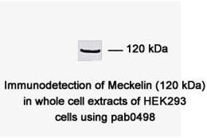 Image no. 1 for anti-Transmembrane Protein 67 (TMEM67) (C-Term) antibody (ABIN347657) (TMEM67 antibody  (C-Term))