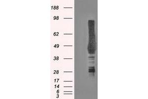 HEK293T cells were transfected with the pCMV6-ENTRY control (Left lane) or pCMV6-ENTRY CA9 (Right lane) cDNA for 48 hrs and lysed. (CA9 antibody)