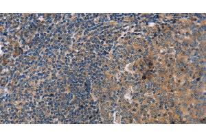 Immunohistochemistry of paraffin-embedded Human tonsil using PPP2R3C Polyclonal Antibody at dilution of 1:30 (PPP2R3C antibody)