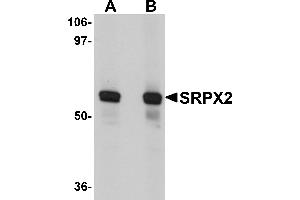Western Blotting (WB) image for anti-Sushi-Repeat Containing Protein, X-Linked 2 (SRPX2) (N-Term) antibody (ABIN1031586) (SRPX2 antibody  (N-Term))
