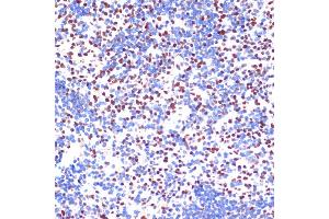 Immunohistochemistry of paraffin-embedded mouse spleen using PELP1 antibody (ABIN6130610, ABIN6145442, ABIN6145443 and ABIN6217403) at dilution of 1:100 (40x lens). (PELP1 antibody)