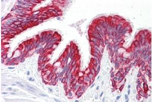 Anti-Keratin 5/8 antibody IHC staining of human lung, respiratory epithelium. (Keratin 5/8 antibody)