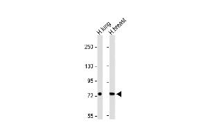 All lanes : Anti-SLC6A14 Antibody (C-term) at 1:1000 dilution Lane 1: Human lung lysate Lane 2: Human breast lysate Lysates/proteins at 20 μg per lane. (Slc6a14 antibody  (C-Term))