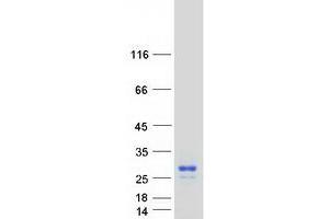 Validation with Western Blot (GPM6A Protein (Transcript Variant 2) (Myc-DYKDDDDK Tag))