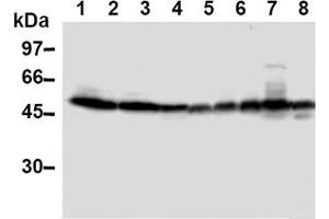 Western Blotting (WB) image for anti-Thioredoxin Interacting Protein (TXNIP) antibody (ABIN567794)