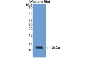 Detection of Recombinant PEX2, Human using Polyclonal Antibody to Peroxisomal Biogenesis Factor 2 (PEX2) (PEX2 antibody  (AA 233-305))