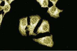 Immunofluorescent staining of HeLa cells with anti-Itch antibody. (ITCH antibody  (AA 114-220))