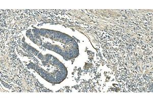 IHC analysis of IDH2 using anti-IDH2 antibody (ABIN7602787). (IDH2 antibody  (C-Term))