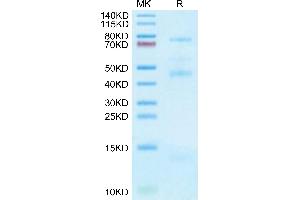 Human GARP&Latent TGF Beta 2 Complex on Tris-Bis PAGE under reduced condition.