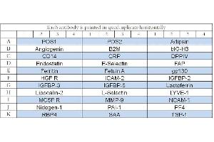 Image no. 1 for Human Serum Abundant Protein Array Q2 (ABIN4956069) (Human Serum Abundant Protein Array Q2)