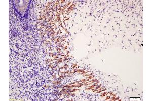 anti-Myosin Light Chain 6, Alkali, Smooth Muscle and Non Muscle (MYL6) (pSer30), (pTyr29) antibody