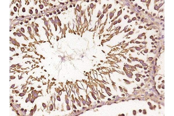 RNF170 antibody