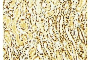 ABIN6269069 at 1/100 staining Mouse kidney tissue by IHC-P. (SNAIL antibody  (C-Term))