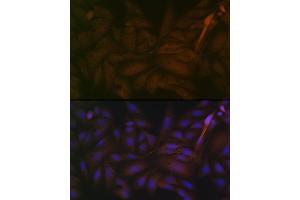 Immunofluorescence analysis of U-2 OS cells using PP2A alpha + beta Rabbit mAb (ABIN7269686) at dilution of 1:100 (40x lens). (PPP2CB antibody)