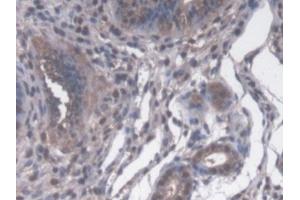 IHC-P analysis of Mouse Uterus Tissue, with DAB staining.