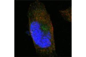 Confocal immunofluorescence analysis of PANC-1 cells using SORL1 mouse mAb (green). (SORL1 antibody)