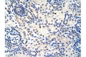 RNASEH2A antibody was used for immunohistochemistry at a concentration of 4-8 ug/ml to stain Epithelial cells of renal tubule (arrows) in Human Kidney. (RNASEH2A antibody  (C-Term))