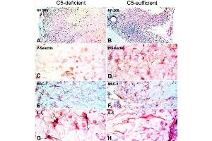 Immunohistochemistry of C5-d and C5-s mice with EAE. (Guinea Pig Spinal Cord)