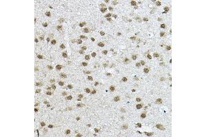 Immunohistochemistry of paraffin-embedded mouse brain using NCOR2 Rabbit pAb (ABIN6130575, ABIN6144422, ABIN6144423 and ABIN6224431) at dilution of 1:100 (40x lens).