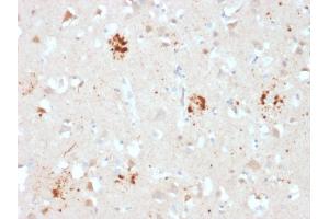 Formalin-fixed, paraffin-embedded human Brain stained with Ubiquitin Mouse Monoclonal Antibody (UBB/2122). (Ubiquitin B antibody  (AA 1-119))