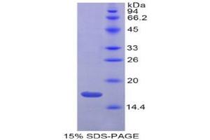 SDS-PAGE (SDS) image for Gastrokine 3 (GKN3) (AA 38-177) protein (His tag) (ABIN1878450) (Gastrokine 3 Protein (GKN3) (AA 38-177) (His tag))
