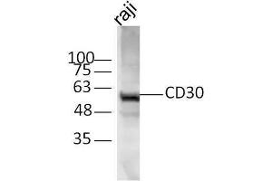 Raji cell lysates probed with Rabbit Anti-CD30 Polyclonal Antibody, Unconjugated  at 1:500 for 90 min at 37˚C. (TNFRSF8 antibody  (AA 131-230))