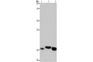 Western Blotting (WB) image for anti-Cytochrome b5 (CYTB5) antibody (ABIN2429884) (Cytochrome b5 (CYTB5) antibody)
