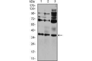 Western blot analysis using CIDEC mouse mAb against HEK293 (1), A431 (2), and HCT116 (3) cell lysate. (CIDEC antibody  (AA 53-141))